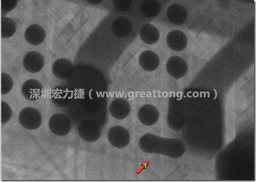 BGA因?yàn)楹笁|變小，造成錫膏過(guò)多而最終形成焊接短路的結(jié)果。